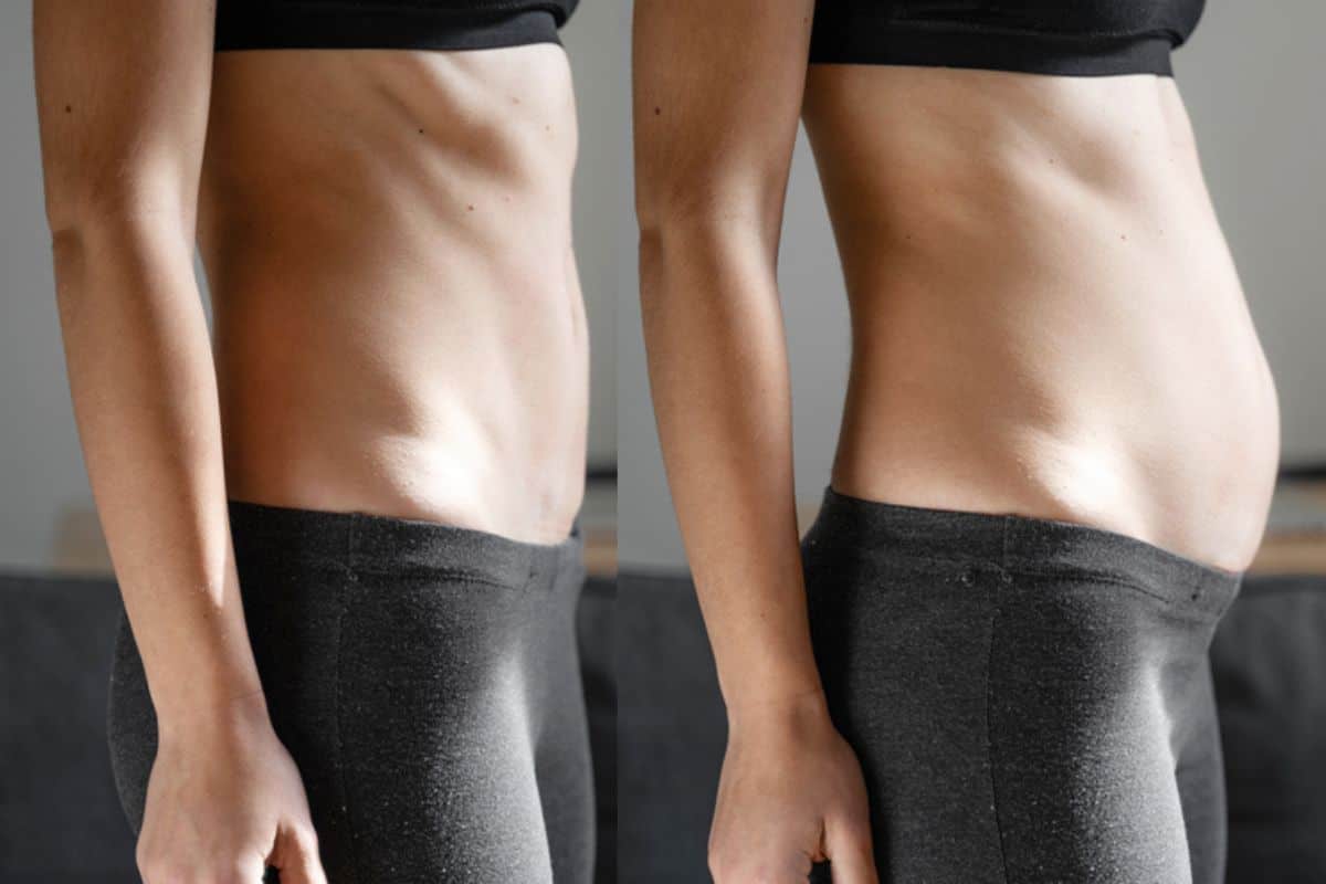 How long does diastasis recti take to improve Aylesbury?