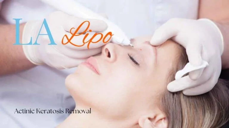 Woman receiving Actinic Keratosis Removal Treatment Aylesbury
