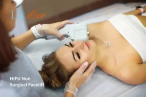 Woman having Hi-Fu to reduce wrinkles Aylesbury.