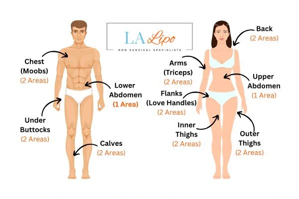 LA LIPO Cryolipolysis Areas Aylesbury
