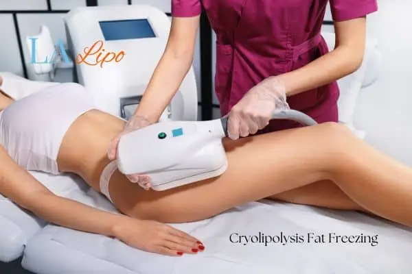 Woman receiving coolsculpting Aylesbury treatment on her thighs