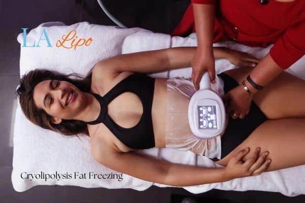 woman getting cryolipolysis Aylesbury