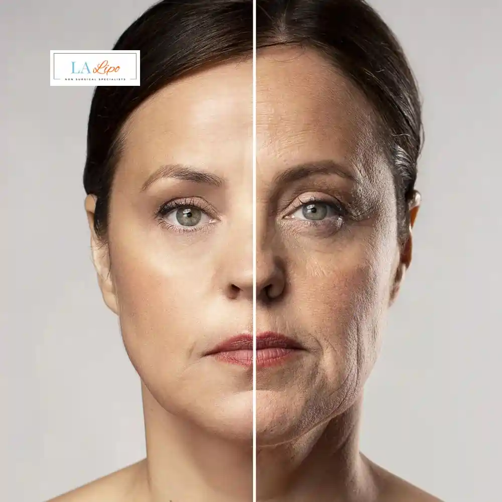 How Can You Tell If Non-Surgical Skin Tightening Is Right for You Aylesbury?