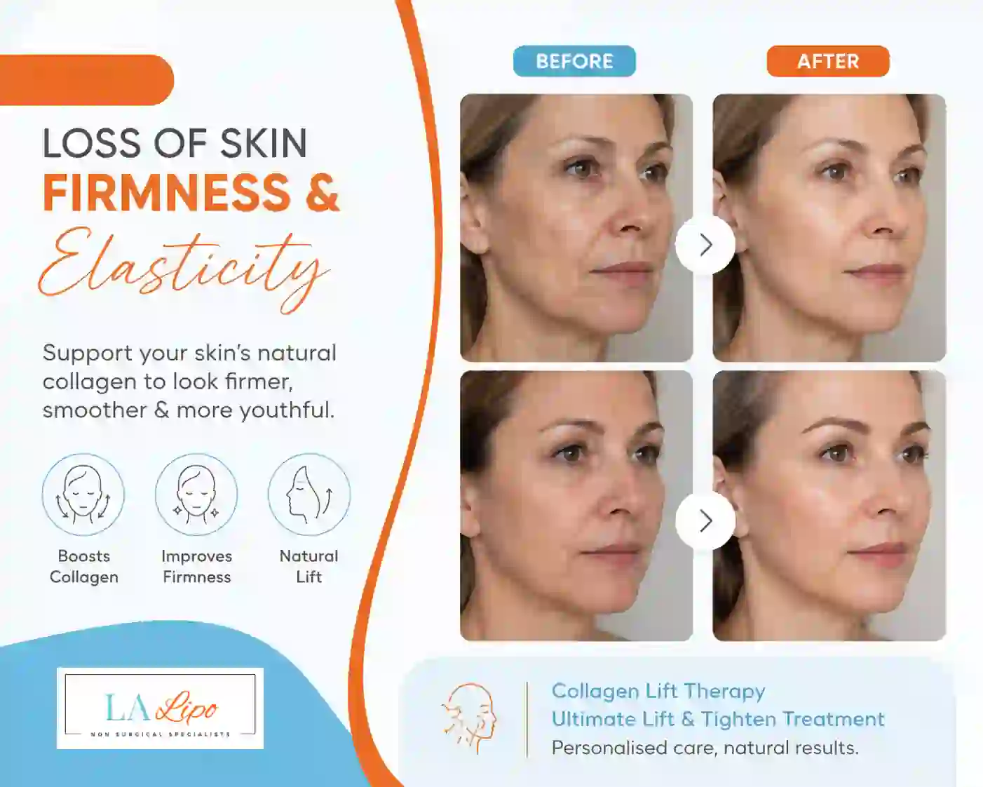 Sign #7: Loss of Skin Firmness and Elasticity Aylesbury