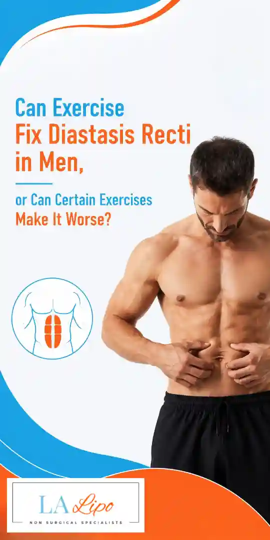 Can Exercise Fix Diastasis Recti in Men, or Can Certain Exercises Make It Worse Aylesbury?